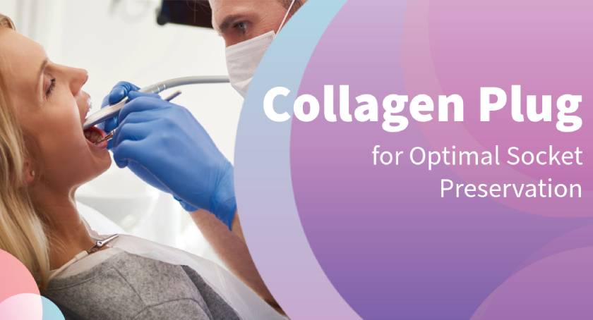 Collagen Plug for Optimal Socket Preservation